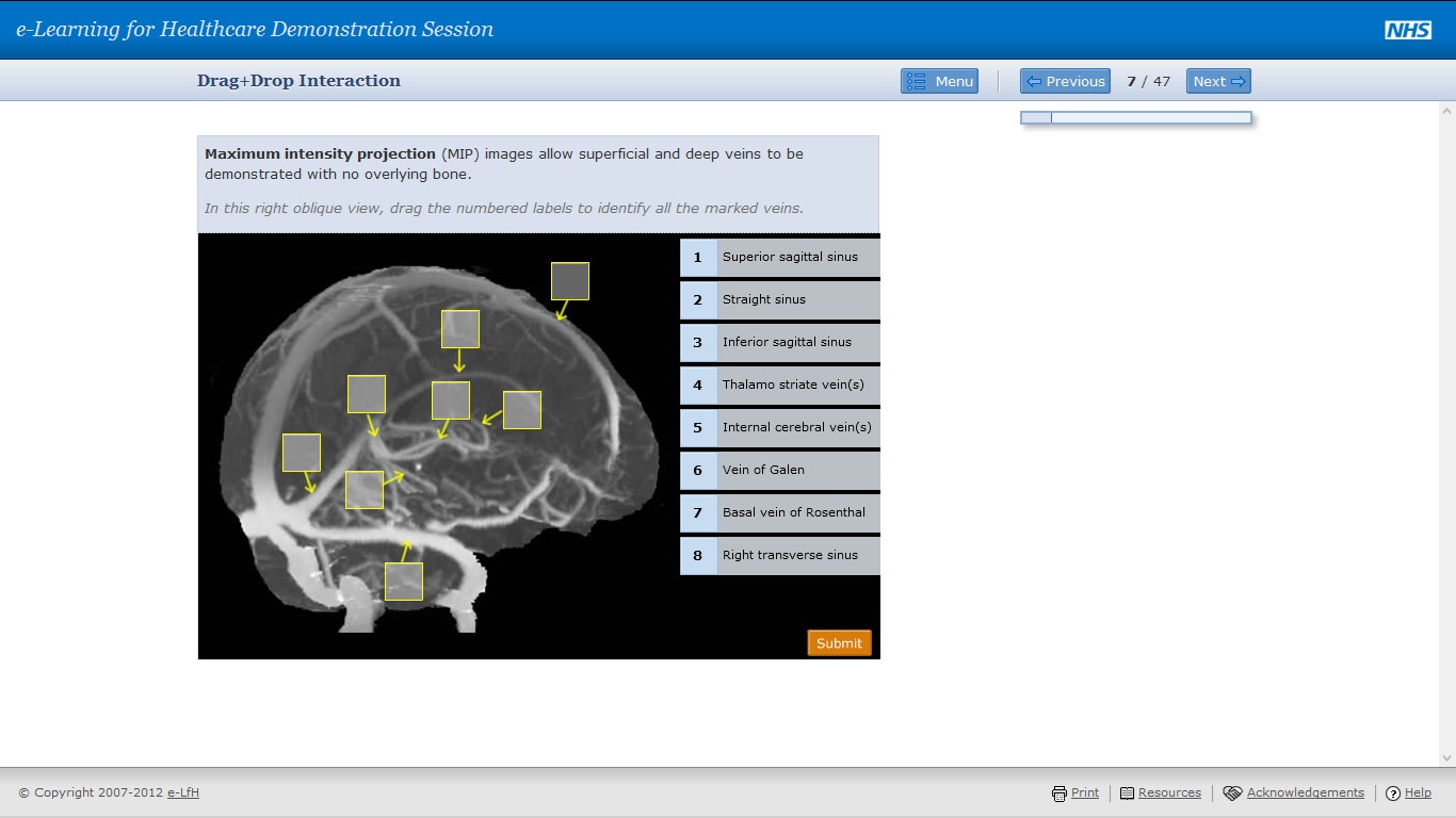 Drag and drop labelling screen with anatomical scan and numbered draggable labels.
